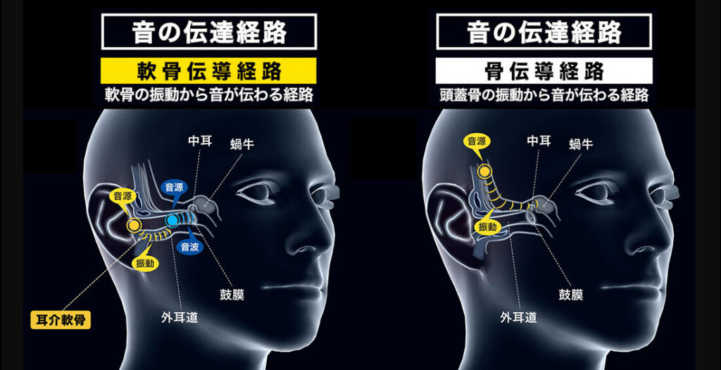 軟骨伝導と骨伝導の違い